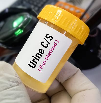 urine c/s test normal results|Urine Culture And Sensitivity Test .